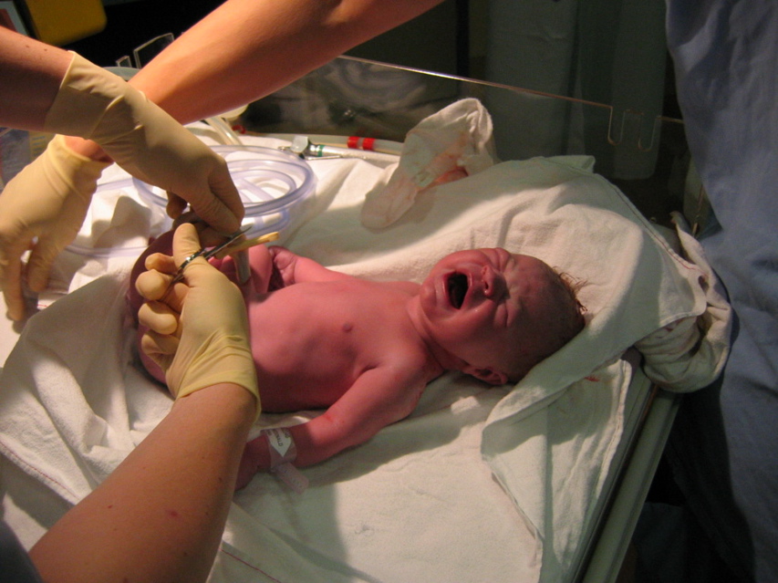 1.18am 5 Oct - Royal Womens - 4